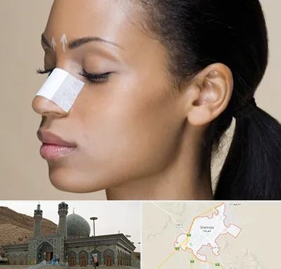 دکتر جراح بینی خانم در شهرضا