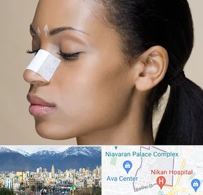 دکتر جراح بینی خانم در آجودانیه 