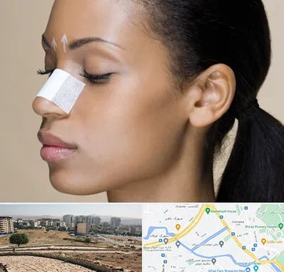 دکتر جراح بینی خانم در کوی وحدت شیراز 