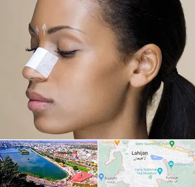 دکتر جراح بینی خانم در لاهیجان