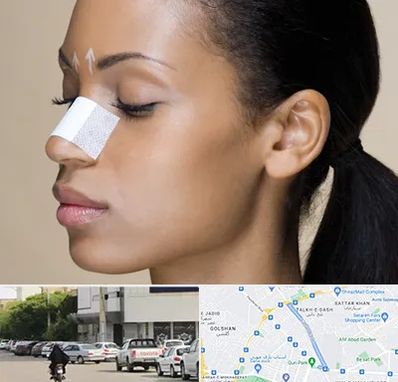 دکتر جراح بینی خانم در قدوسی شرقی شیراز 