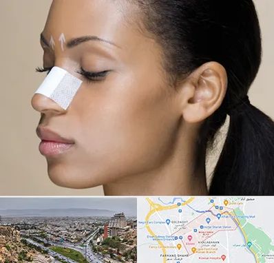 دکتر جراح بینی خانم در معالی آباد شیراز 