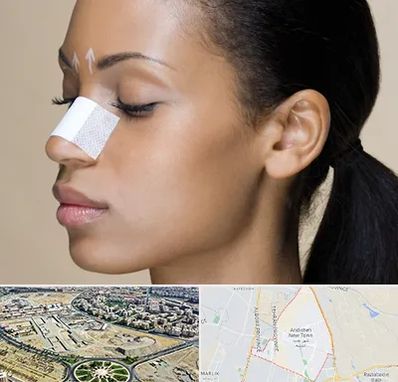 دکتر جراح بینی خانم در اندیشه