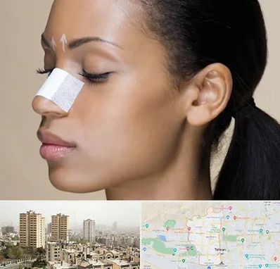 دکتر جراح بینی خانم در منطقه 5 تهران 