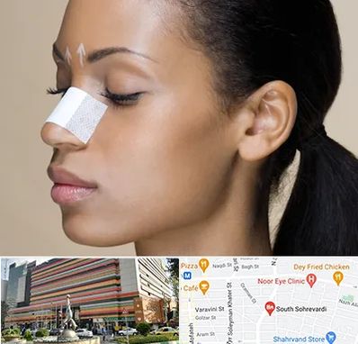 دکتر جراح بینی خانم در سهروردی 