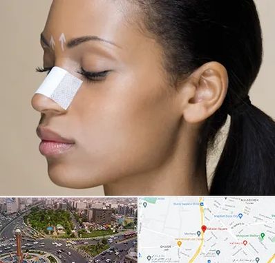 دکتر جراح بینی خانم در سبلان 