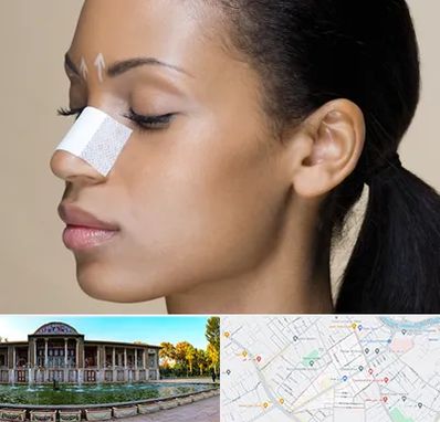 دکتر جراح بینی خانم در عفیف آباد شیراز 