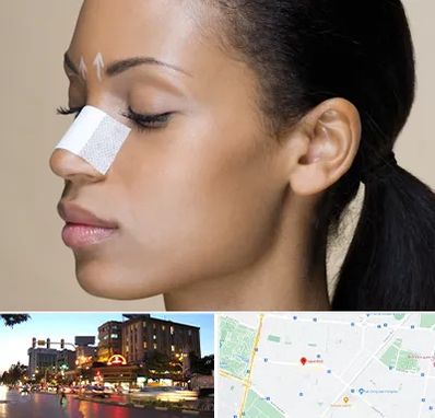 دکتر جراح بینی خانم در بلوار سجاد مشهد 