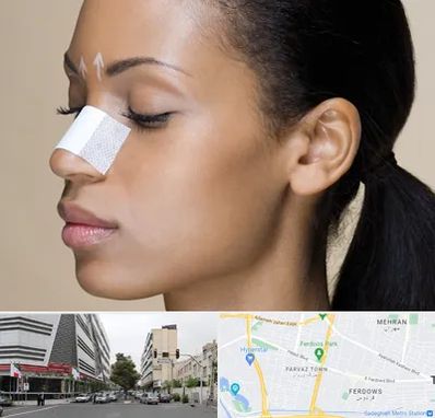 دکتر جراح بینی خانم در بلوار فردوس 