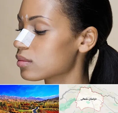 دکتر جراح بینی خانم در خراسان شمالی