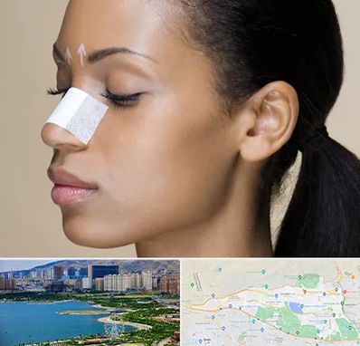 دکتر جراح بینی خانم در منطقه 22 تهران 