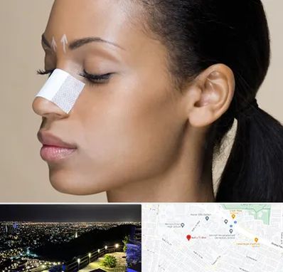 دکتر جراح بینی خانم در هفت تیر مشهد 