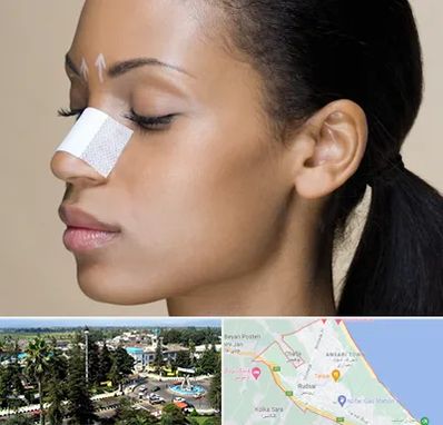 دکتر جراح بینی خانم در رودسر