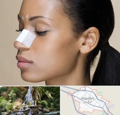 دکتر جراح بینی خانم در الیگودرز