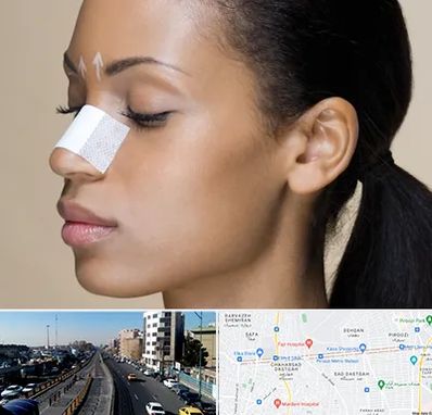 دکتر جراح بینی خانم در پیروزی 