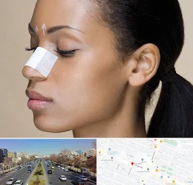 دکتر جراح بینی خانم در بلوار معلم مشهد 