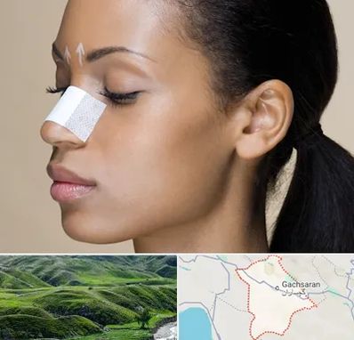 دکتر جراح بینی خانم در گچساران
