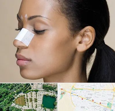 دکتر جراح بینی خانم در وکیل آباد مشهد 