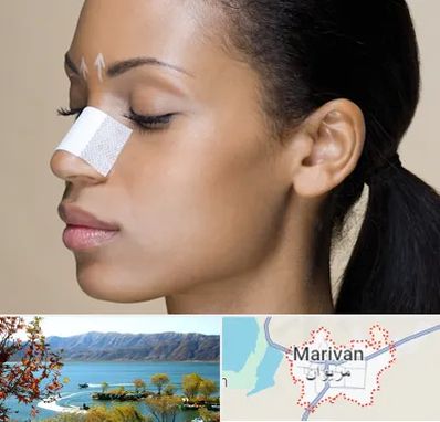 دکتر جراح بینی خانم در مریوان