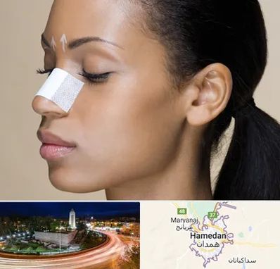 دکتر جراح بینی خانم در همدان