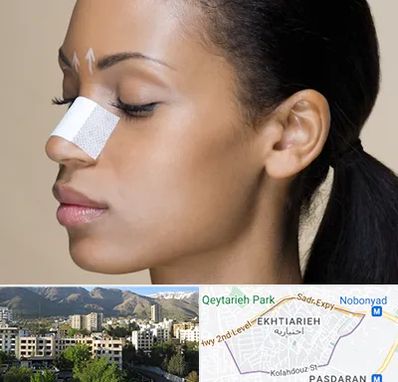 دکتر جراح بینی خانم در اختیاریه 