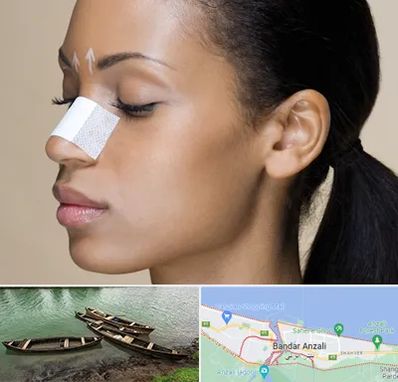 دکتر جراح بینی خانم در بندر انزلی