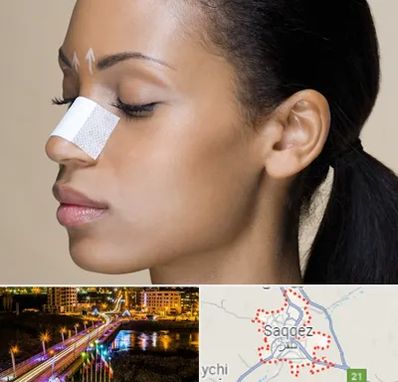 دکتر جراح بینی خانم در سقز