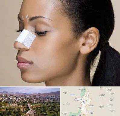 دکتر جراح بینی خانم در بوکان