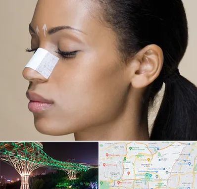 دکتر جراح بینی خانم در منطقه 3 تهران 