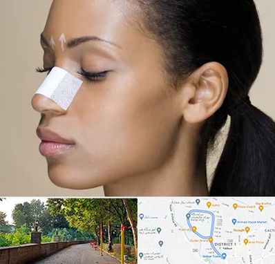 دکتر جراح بینی خانم در فلکه گاز رشت 