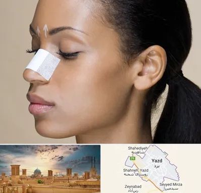 دکتر جراح بینی خانم در یزد
