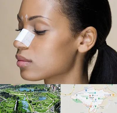 دکتر جراح بینی خانم در بجنورد