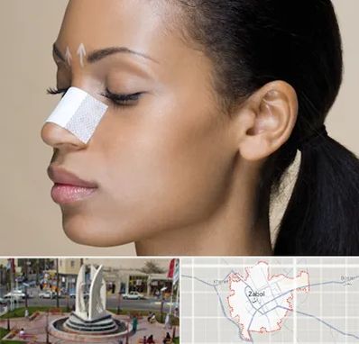 دکتر جراح بینی خانم در زابل