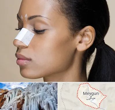 دکتر جراح بینی خانم در میگون