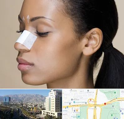 دکتر جراح بینی خانم در حقانی 