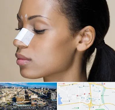 دکتر جراح بینی خانم در شهرک راه آهن 