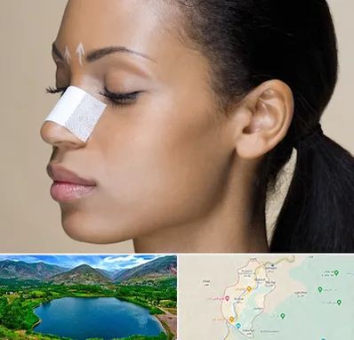 دکتر جراح بینی خانم در رودبار