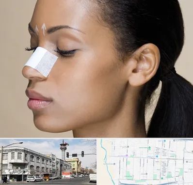 دکتر جراح بینی خانم در 17شهریور