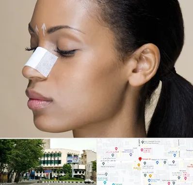 دکتر جراح بینی خانم در طالقانی 