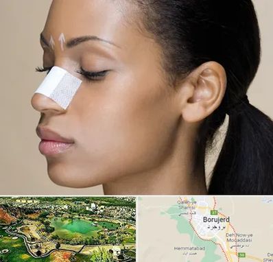 دکتر جراح بینی خانم در بروجرد