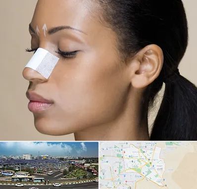 دکتر جراح بینی خانم در منطقه 15 تهران 