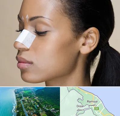 دکتر جراح بینی خانم در رامسر