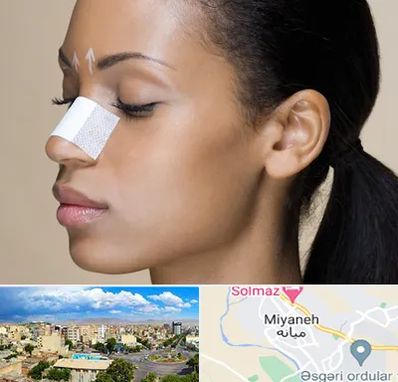 دکتر جراح بینی خانم در میانه