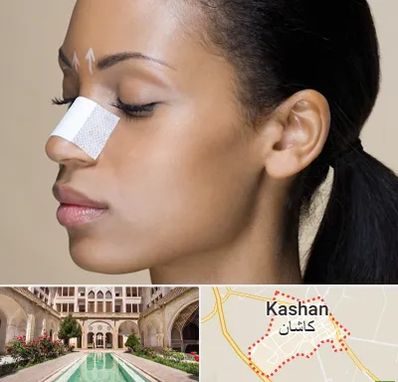 دکتر جراح بینی خانم در کاشان