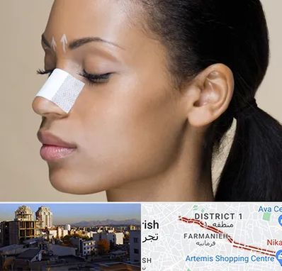 دکتر جراح بینی خانم در فرمانیه 