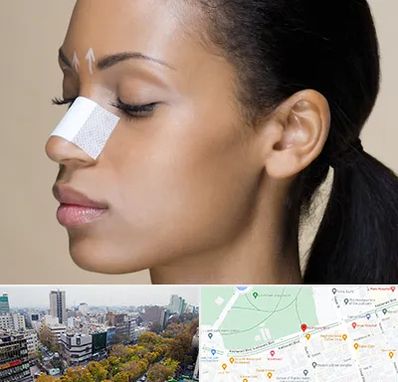 دکتر جراح بینی خانم در بلوار کشاورز 