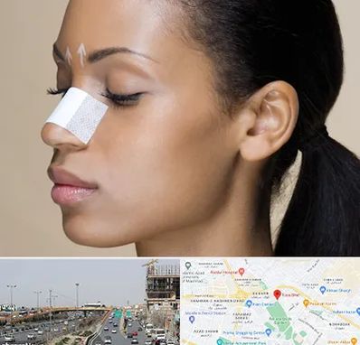 دکتر جراح بینی خانم در بلوار توس مشهد 