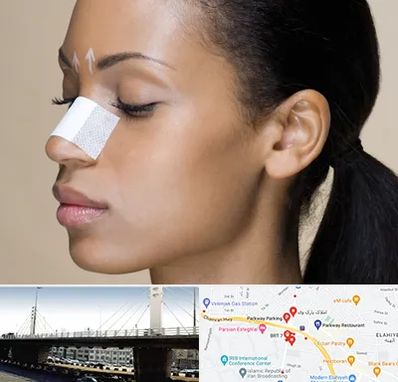 دکتر جراح بینی خانم در پارک وی 