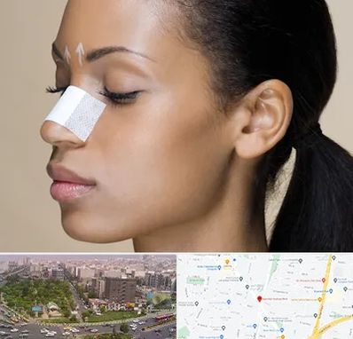 دکتر جراح بینی خانم در آیت الله کاشانی 