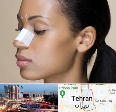 دکتر جراح بینی خانم در صادقیه 